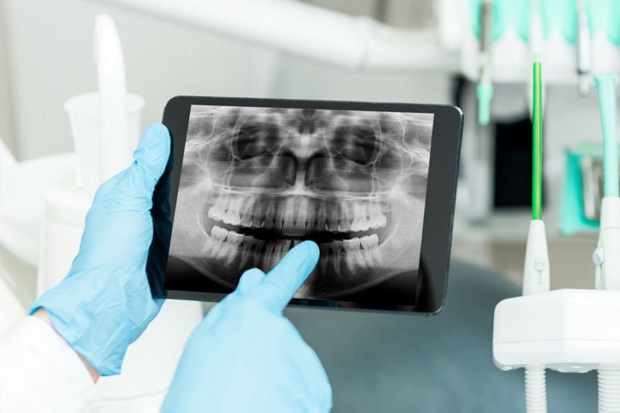 Dijital Diş Hekimliği